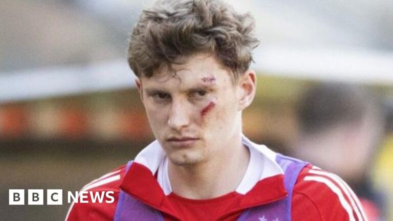 A man on the pitch after Abardin football player in the game